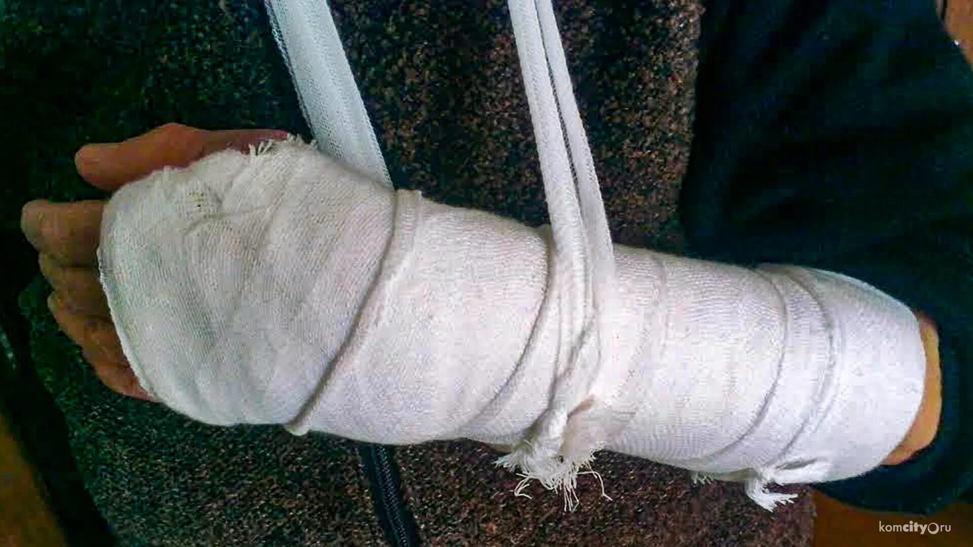 бабушке сломали руку. бабушке сломали руку. бабушке сломали руку. бабушки разбивают компьютер. бабушке сломали руку.