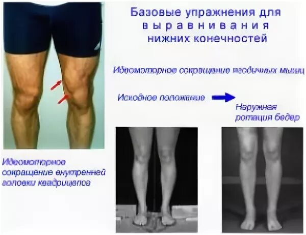 внутренние бедра у женщин. внутренняя часть бедра у женщин. внутреняя поверхность бёдер. внутренние бедра у женщин. идеальная форма ног.