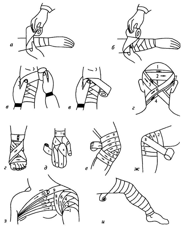 Техника бинтования десмургия. Повязка на кисть десмургия. Десмургия повязки алгоритм. Перевязка предплечья эластичным бинтом. Перевязывать форум