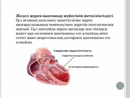Нейлон киген жалаңаш брюнеткалар 18