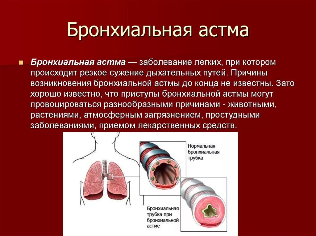 Астма заболевание дыхательных. Сужение дыхательных путей. Сужение бронхов причины. Наличие стеноза дыхательных путей. Первая помощь при приступе бронхиальной астмы.