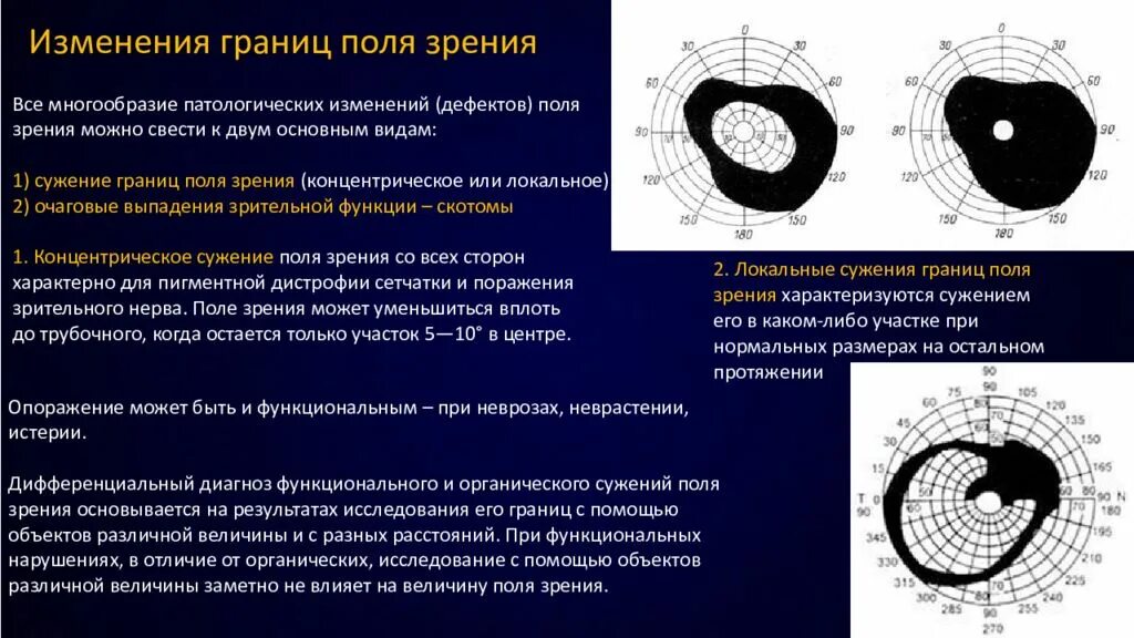 Какие точки зрения на причины и способы. Концентрическое сужение полей зрения. Локальное сужение полей зрения. Концентрическое сужение полей зрения причины. Периметрия сужение полей зрения.