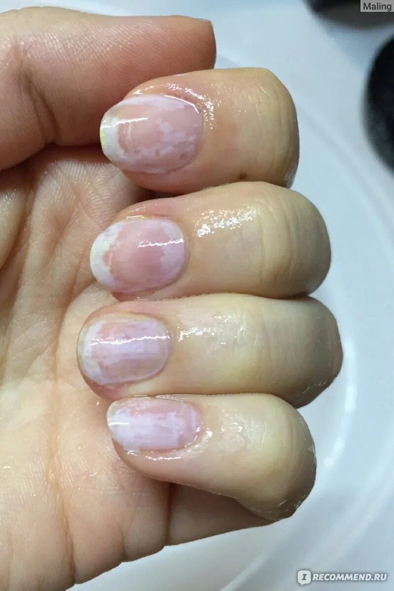 Ногти после нарощенных ногтей. Ногти после снятия гель. Белые ногти после снятия гель лака. Карманы на ногтях после шеллака. Белые ногти после снятия лака.