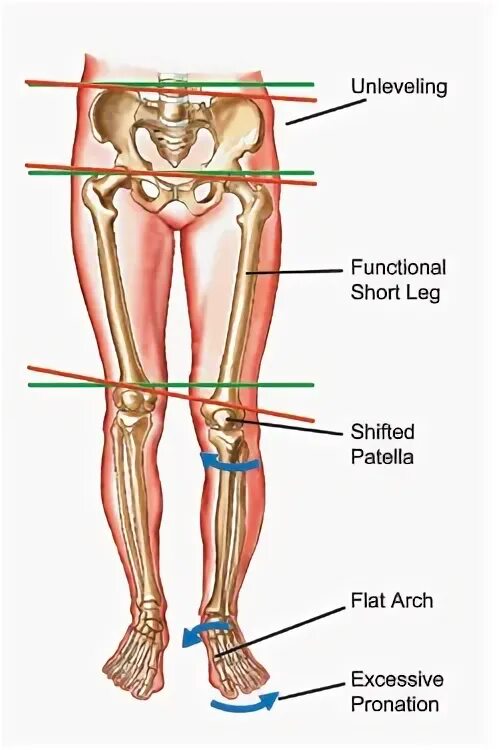 Shifting the Leg. SLLD Leg Shift. SLLD Leg Shift length. Переведи legs