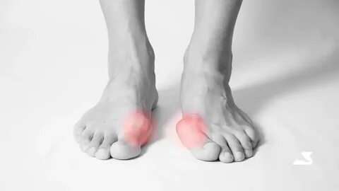 Ankle feet