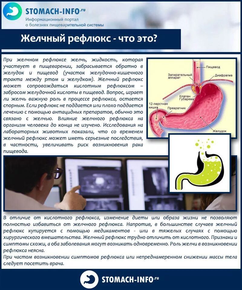 Атрофический рефлюкс. Гастральный рефлюкс желчи. Дуоденальное билиарный рефлюкс.