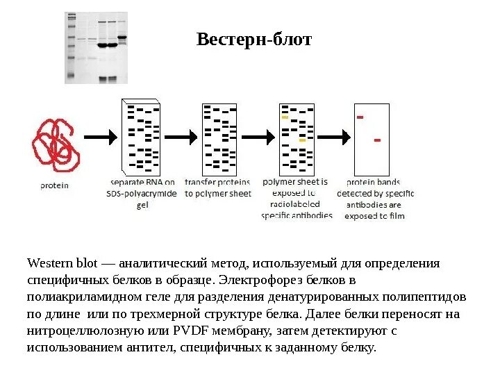 Вестерн блоттинг методика. Вестерн блоттинг схема. Электрофорез структура белков. Электрофорез блоттинг. Иммунный блоттинг