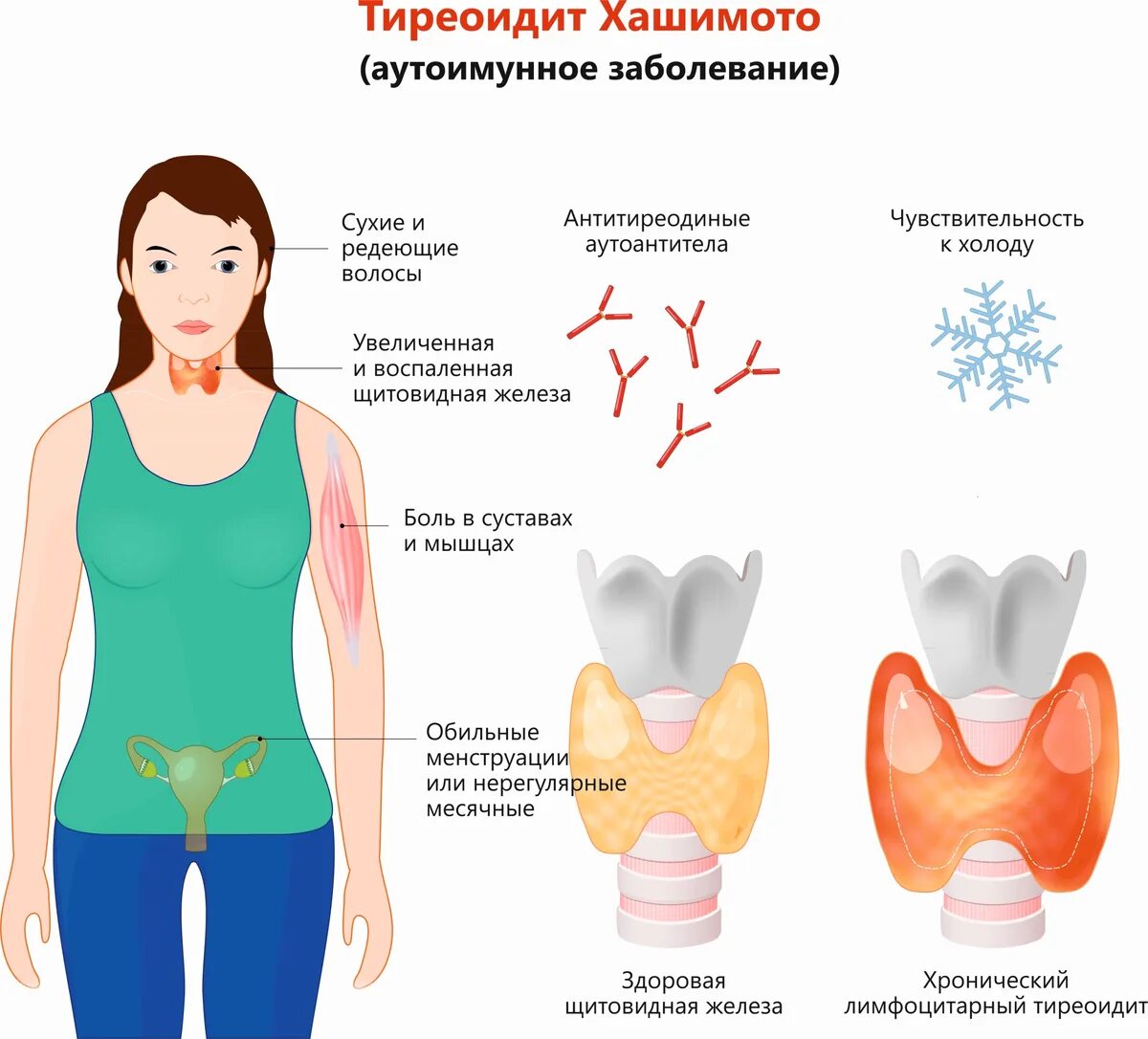 Что такое щитовидная железа