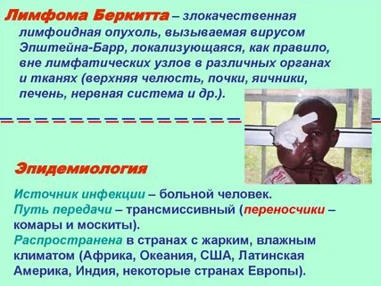 Злокачественная опухоль лимфомы