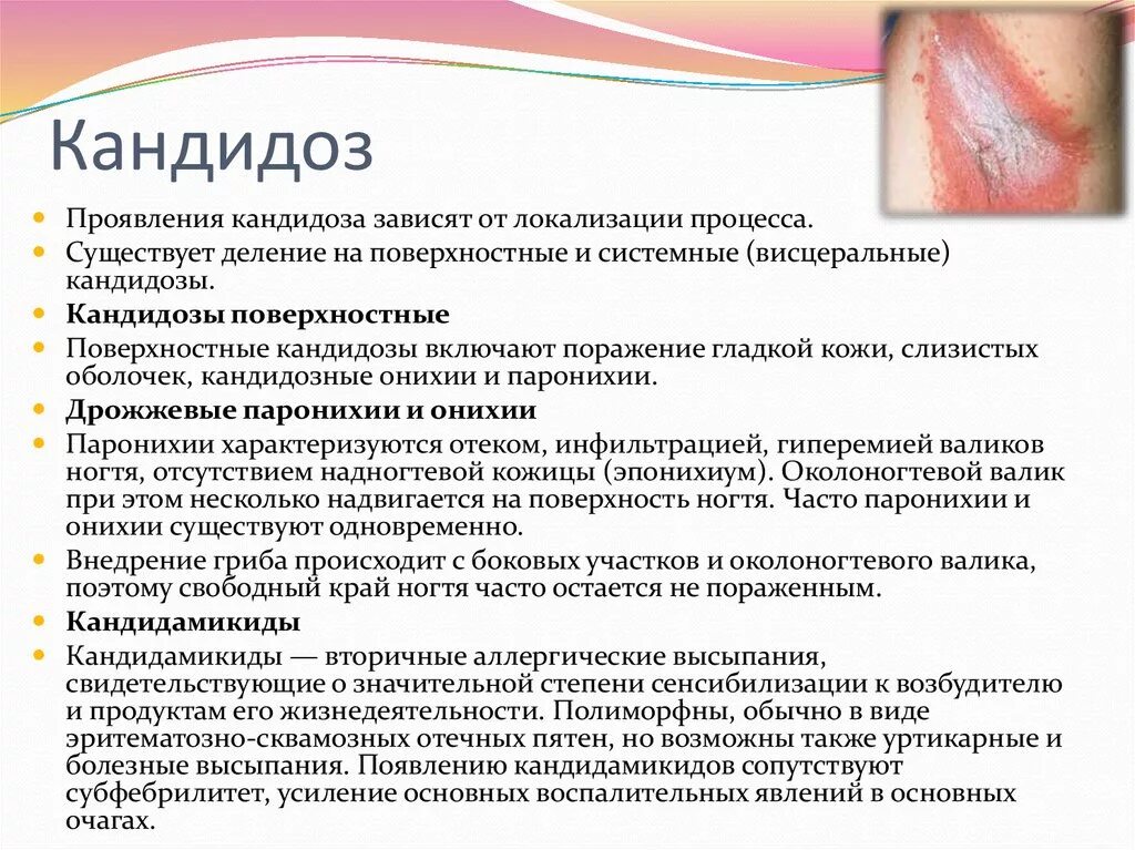 Лечение острого контактного дерматита