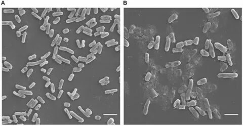 Кишечная палочка е coli. Лактозонегативная кишечная палочка. E coli гемолитические 10. E coli гемолитические 10. Бактерия escherichia coli.