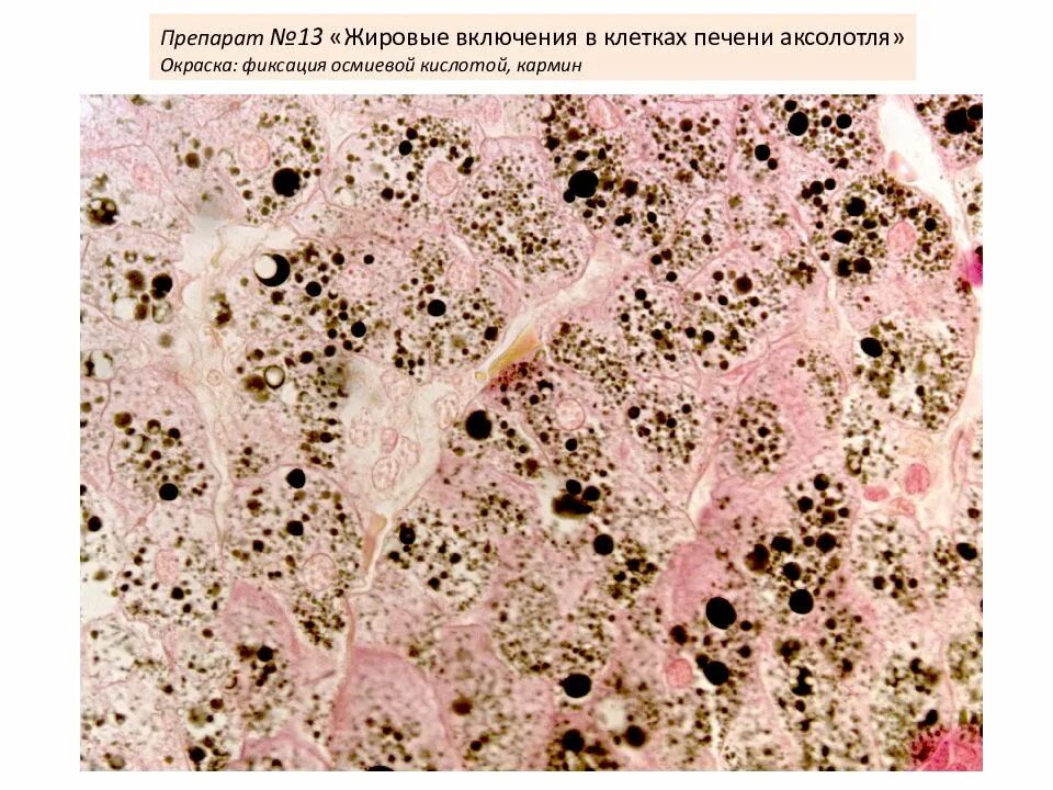 Митохондрии в клетках печени. Включения жира в клетках печени аксолотля. Окраска осмиевой кислотой гистология. Включения жира в клетках печени гистология. Жировые включения препарат гистология.