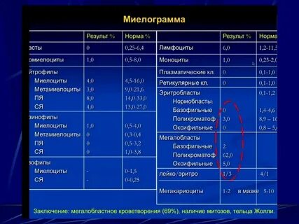 Миелограмма