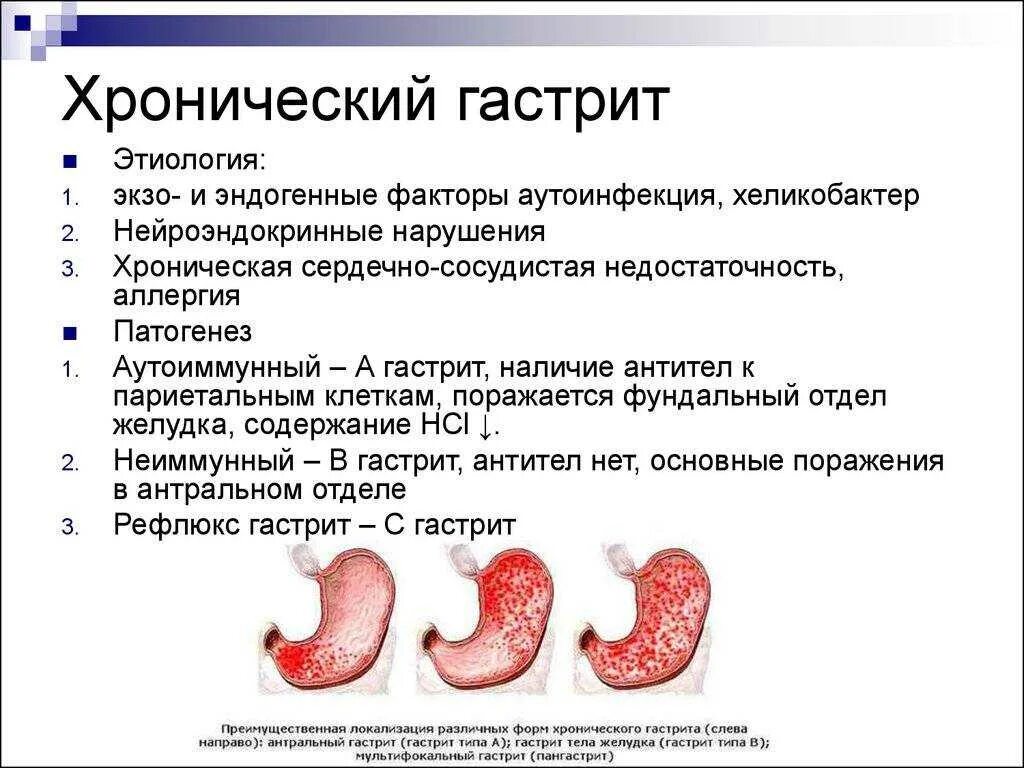 Как лечить желудок симптомы. Патогенез хронического гастрита хеликобактер пилори. антральный гастрит синдромы. хронический антральный гастрит. фундальный гастрит симптомы.