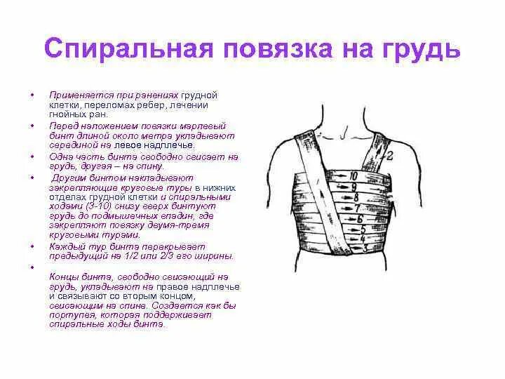 Повязка на грудную клетку алгоритм. Спиралевидная повязка на грудную клетку при переломе ребер. При переломе ребер повязку на грудную клетку накладывают в состоянии. Спиральная повязка при переломе ребер. Наложение спиральной повязки на грудную клетку.