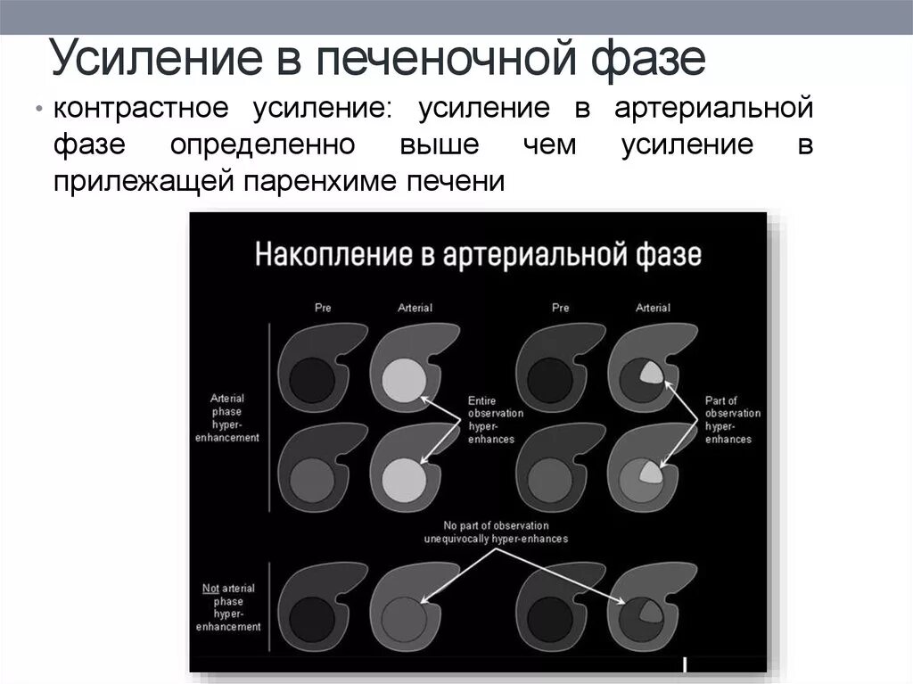 Чем характеризовался усиливавшийся контраст. Дифференциальная диагностика образований печени. Дифференциальная диагностика образований печени мрт. Диф диагностика образований печени кт. Контрастирование образований печени.