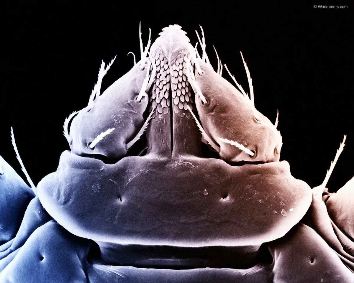 Мошка под микроскопом фото. Астраханская мошка под микроскопом. Зубы мошкары под микроскопом. Мошка под микроскопом челюсти. Мошка гнус под микроскопом.