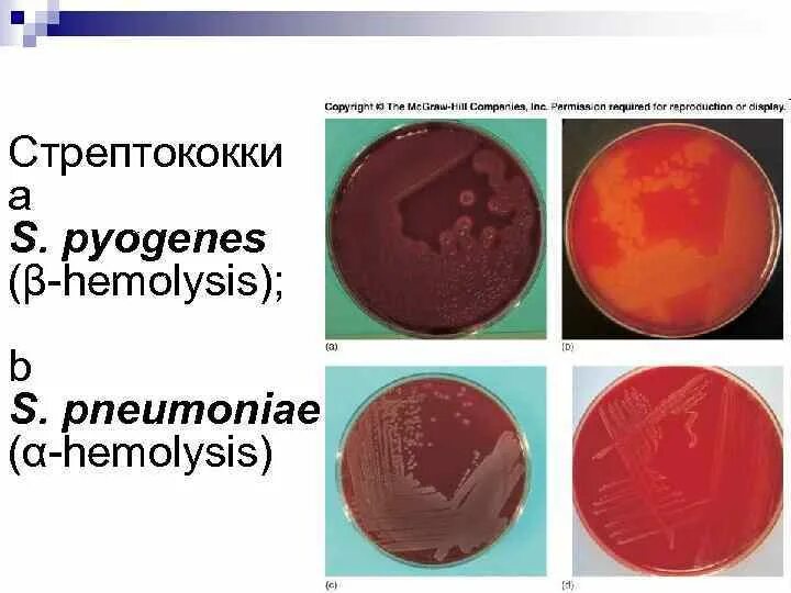 Альфа гемолитический стрептококк. Стрептококкус агаре стрептококк на кровяном. Типы гемолиза стрептококков. Гемолитический стрептококк классификация. Тест стрептококк группы а