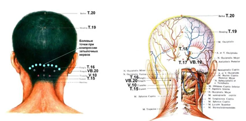 Болезненные точки на голове. Иннервация малого затылочного нерва. Точки на затылочной части головы. Точка у основания черепа. Затылок головы анатомия.