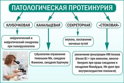 Моча бенс джонса