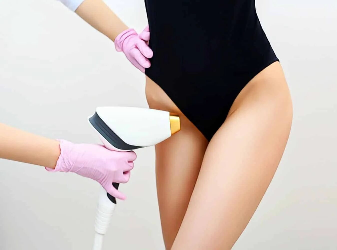 Элос эпиляция бикини. Лазерная эпиляция бикини элос. Удаление волос лазером бикини. Эпиляция бикини. Фотоэпиляция лазерная глубокое бикини.