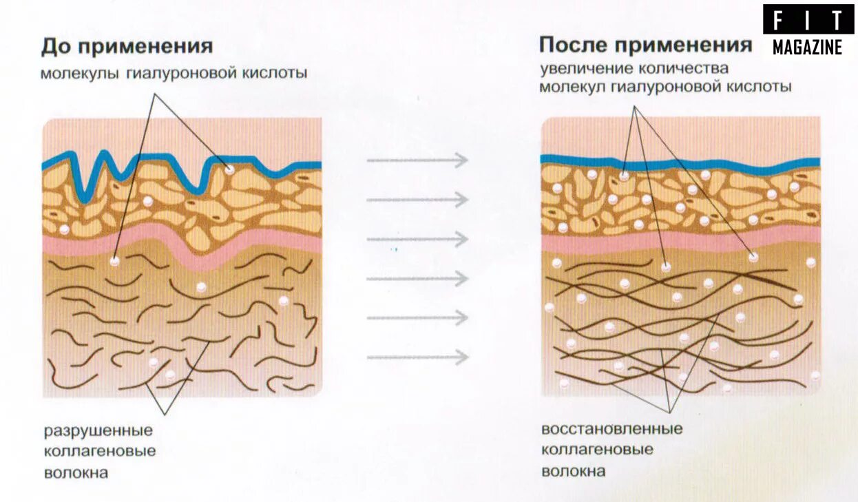 Введение коллаген. Воздействие гиалуроновой кислоты на коллагеновые волокна. Коллагеновое волокно схема кожа. Коллаген эластин фибробласты. Гиалуроновая кислота в коже.