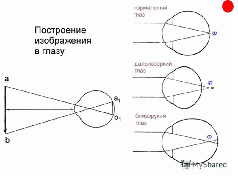 Нормальный глаз схема