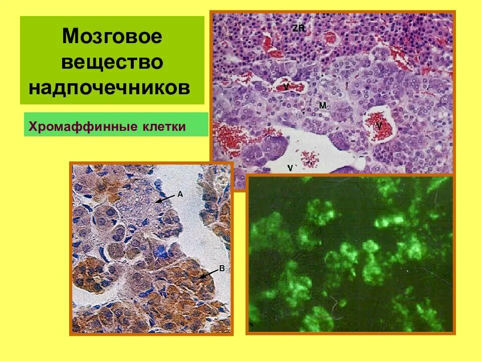 Хромаффинные клетки надпочечников гистология. Строение надпочечников гистология. Хромаффинные клетки надпочечников гистология. Хромаффинные клетки надпочечников. Клетки мозгового вещества надпочечников.