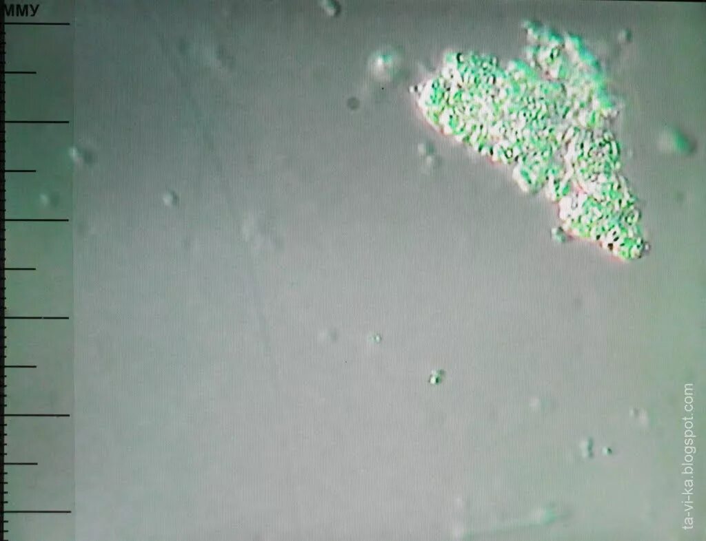 Бактерии в слюне. Слюна под микроскопом. Слюна человека под микроскопом. Бактерии в слюне под микроскопом. Ротовая жидкость под микроскопом.