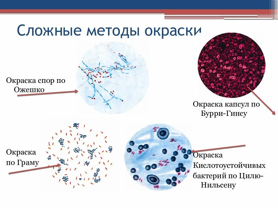 Что значит обнаружены споры. Методы окраски спор бактерий микробиология. Метод окраски спор микробиология. Метод окраски Ожешко микробиология. Методы окраски бактериальных капсул микробиология.