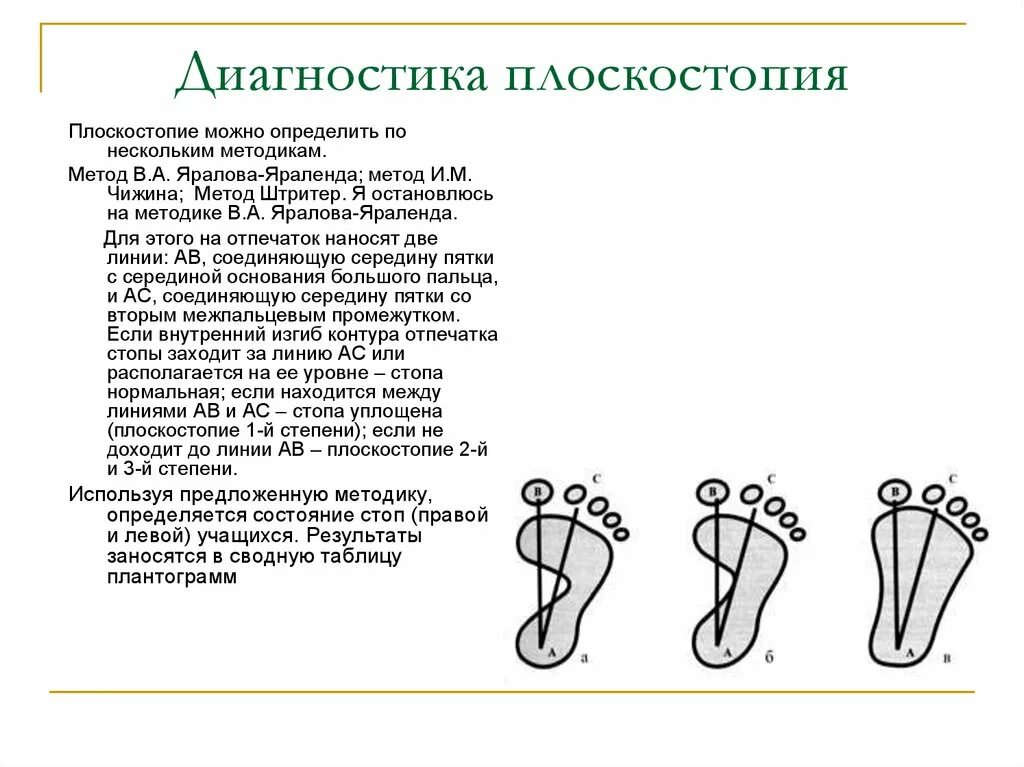 Плоскостопие у детей врач. Метод выявления плоскостопия у детей. Методика измерения плоскостопия. Метод определения плоскостопия по отпечатку стопы. Методика выявления плоскостопия у детей по отпечатку стопы.