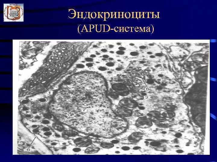 Апуд система гистология. Клетки апуд системы гистология. apud клетки гистология. нейроэндокринные клетки apud системы. диффузная эндокринная система apud.