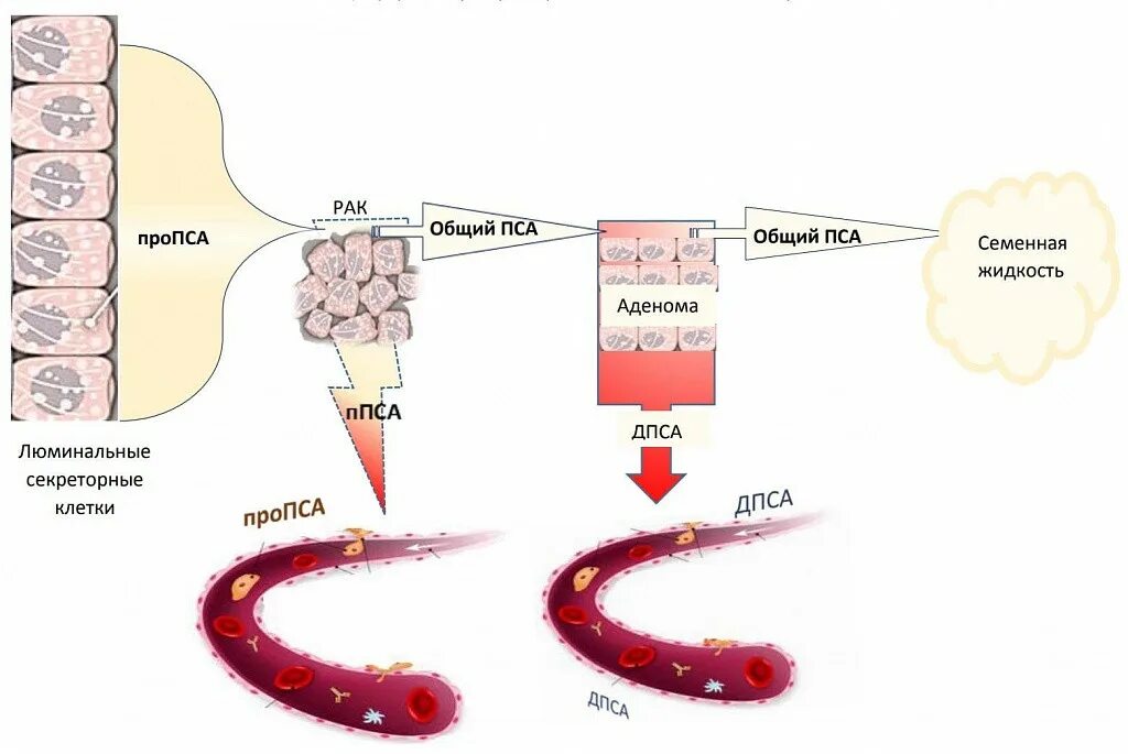 Как сдать пса мужчине подготовка. Простат-специфический антиген общий анализ крови расшифровка. Простатический специфический антиген (пса). Пса анализ для мужчин. Пса общий и Свободный показатели.