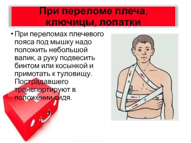 Валик при переломе плеча
