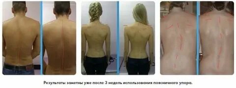 Восстановление спины