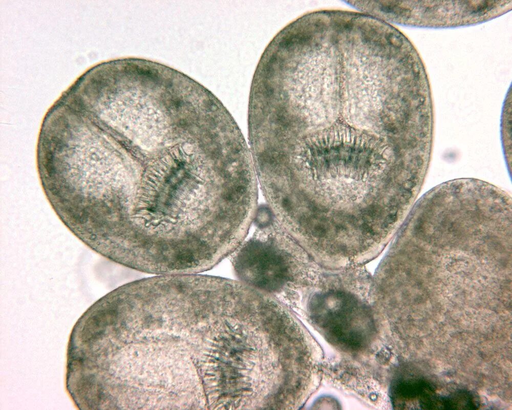 Яйца эхинококка под микроскопом. Echinococcus granulosus яйца микроскоп. Протосколекс эхинококка. Яйцо с онкосферой