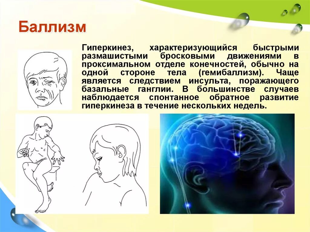 Чаще всего является следствием