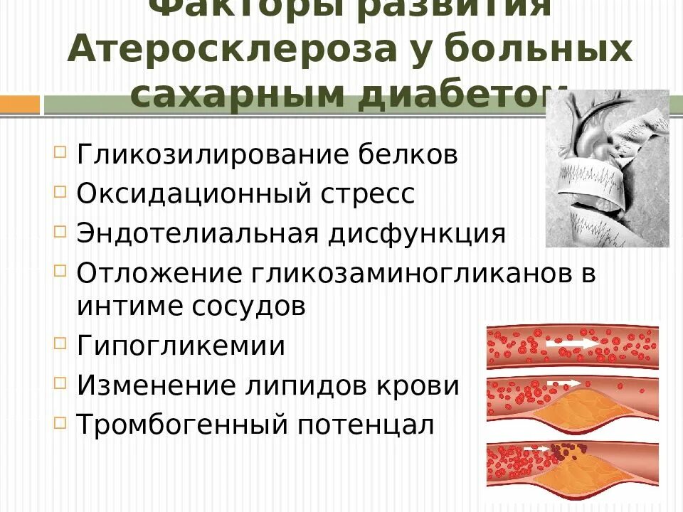 Развитие атеросклероза. Возникновение атеросклероза. причины развития атеросклероза. атеросклероз при сахарном диабете. факторы способствующие возникновению атеросклероза.