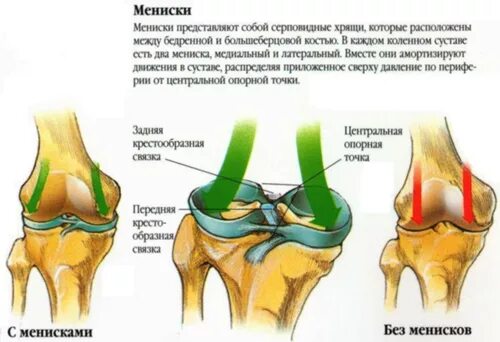 Дегенерация мениска. Повреждение мениска коленного сустава. Разрыв рога медиального мениска коленного сустава. Передний латеральный мениск. Симптоматика повреждения менисков коленного сустава.