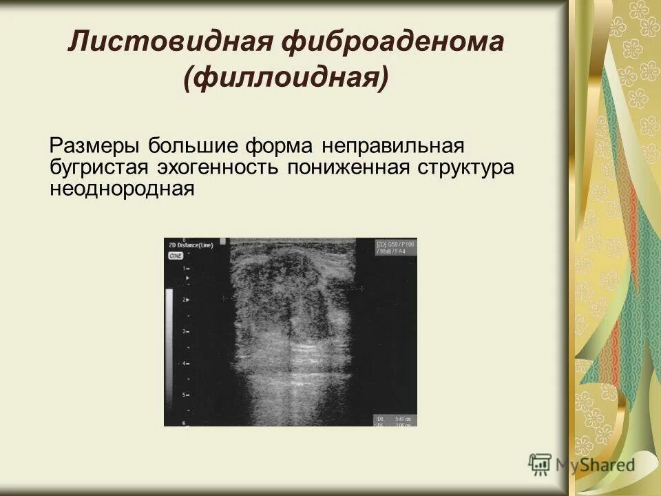 неоднородной структуры нечеткими неровными контурами
