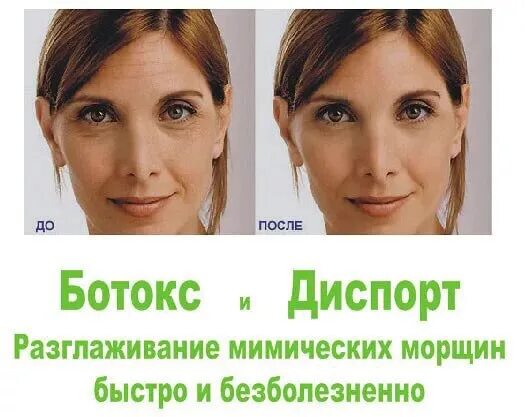 Сколько ботокса нужно в лоб