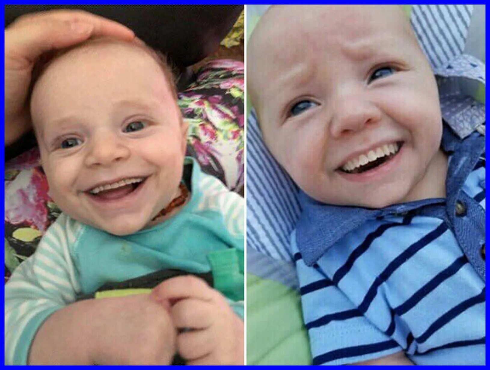 Новорождённые дети с зубами. Новорождëнные с зубами. Люди рожденные на стыке
