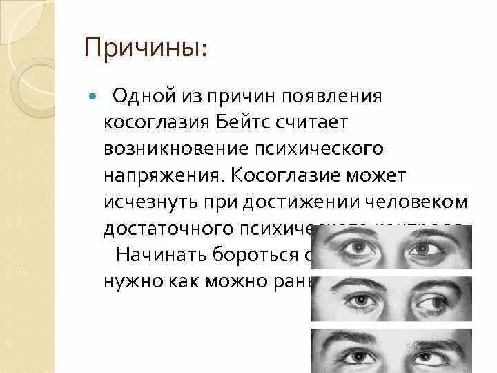 Косит глаз причины. Косоглазие. Косоглазие причины. Причины появления косоглазия. Косоглазие у детей причины.