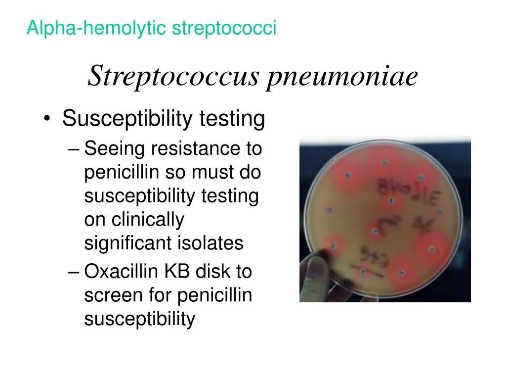 Streptococcus pneumoniae haemophilus influenzae streptococcus. Streptococcus pneumoniae (пневмококк). streptococcus pneumoniae морфология. streptococcus pneumoniae микробиология препарат. стрептококк пневмония микробиология.