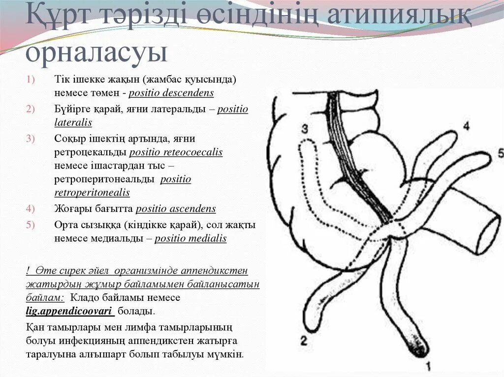 Аппендицит шпаргалка