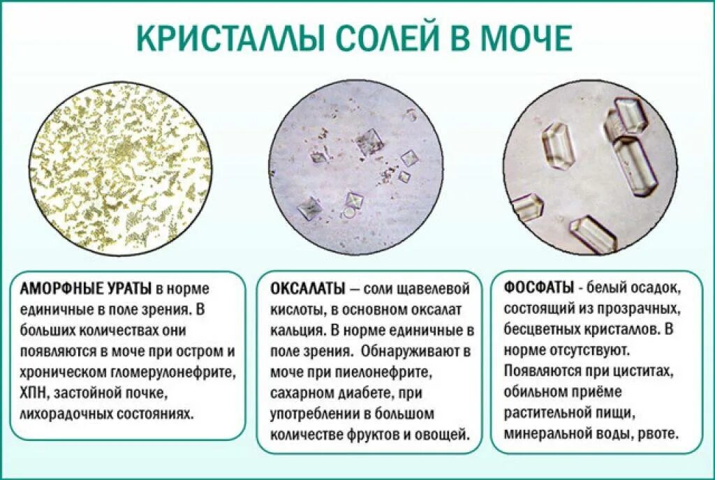 Аморфные Ураты микроскопия мочи. Соли трипельфосфаты. Оксалаты кальция в осадке мочи. Кристаллы оксалата кальция микроскопия.