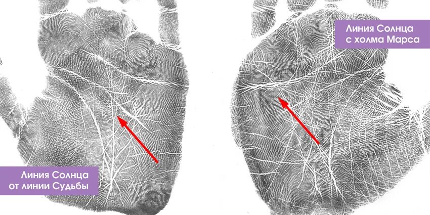 Хиромантия линия солнца. Линия солнца пересекает линию судьбы. Линия солнца от линии жизни. Линия солнца с холма Марса.