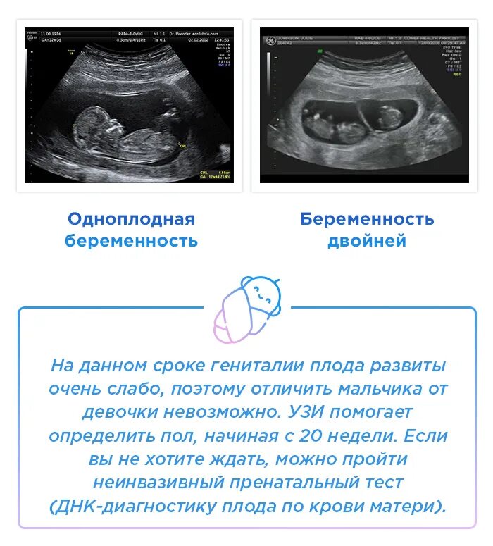 УЗИ 12 недель беременности как понять пол. Как отличают пол плода на УЗИ 12 недель. УЗИ на определение пола ребенка на каком сроке определяется. На каком сроке можно узнать ЕОЛ ребенка. Как отличить на узи