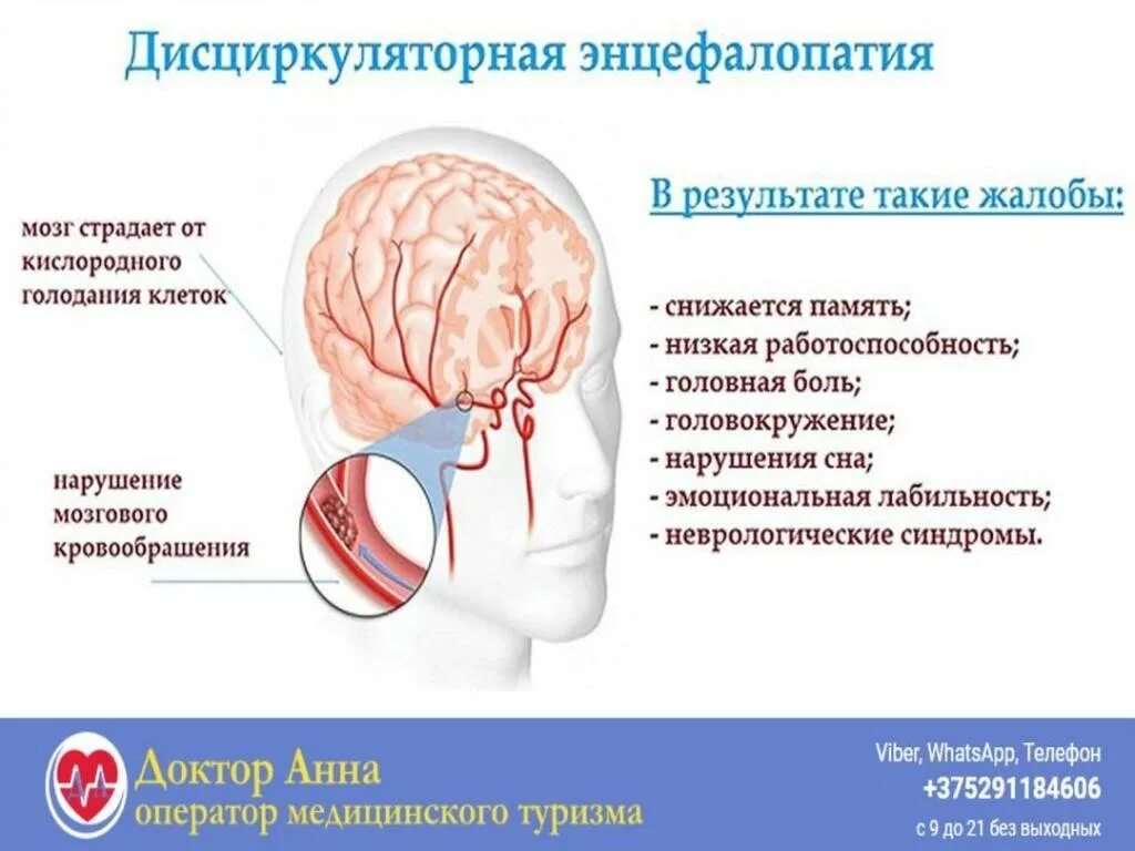 2 стадия головного мозга