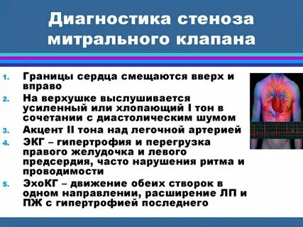 Диагноз стеноз